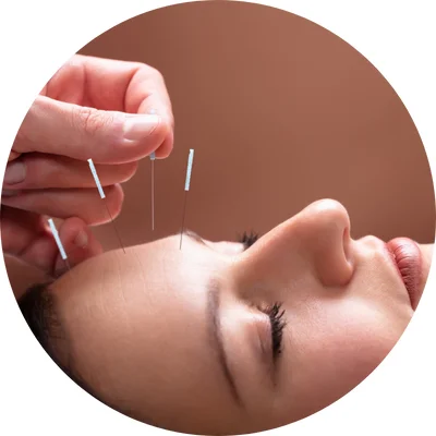 acupuncture central and stanley wellness